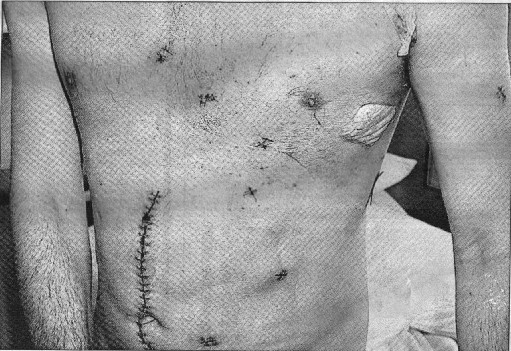 The horrific injuries inflicted on an innocent man who was mugged for his mobile phone